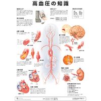 アプライ ミニポスター 高血圧の知識 J9798P（直送品）