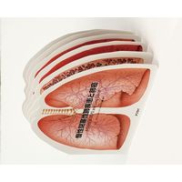 アプライ 型抜き絵本 慢性閉塞性肺疾患と肺癌 TP011（直送品）