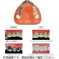 フィード 保険・自費対比模型