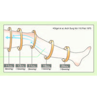 アルケア　アンシルク（R）・プロJ（ストッキング）　L　17432　1足（2本入）