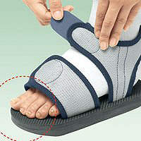 アルケア　キャストサンダル　L（24.5～29.5cm）　17601　1個