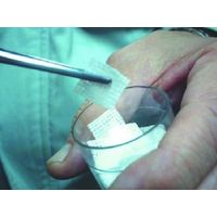 エスコ 200mm [直]ロックピンセット EA595LA-23 1セット(3本:1本×3個)（直送品）