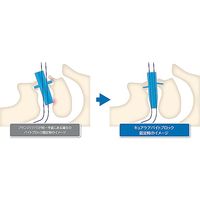アズワン キュアケアバイトブロック シリコンゴム製、Lサイズ 15.5×15.5×62mm 1101 1箱(50個) 8-1111-02（直送品）