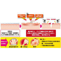 キズカイン 15g 丹平製薬　塗り薬 傷薬 きり傷 すり傷 傷のかゆみ くつずれ 皮膚の殺菌・消毒【第2類医薬品】