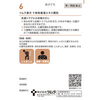 ツムラ漢方〔6〕十味敗毒湯エキス顆粒 20包 ツムラ　漢方薬　化膿性皮膚疾患 じんましん 水虫【第2類医薬品】