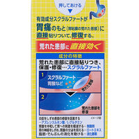 スクラート胃腸薬（錠剤） 102錠 ライオン　空腹時・就寝時の胃痛・胃もたれ・胸やけ【第2類医薬品】