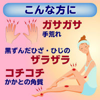 メンソレータムやわらか素肌クリームU 145g ロート製薬　塗り薬 手指のあれ 角化症 乾燥 尿素20%【第3類医薬品】