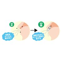 タマハシ イビキ対策キャップ SV-6223 1個（直送品）