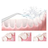 【口腔洗浄器】 充電式口腔洗浄器 ジェットウォッシャー 4種類ノズル付き IPX5防水 3段階水圧調整 1台（直送品）