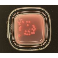 極東製薬工業 DDチェッカー(細菌検出用培地) デオキシコレート寒天培地 大腸菌群検出用 1箱(100枚入) 04211 1箱(100枚)（直送品）