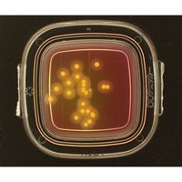 極東製薬工業 DDチェッカー(細菌検出用培地) MSEY寒天培地 黄色ブドウ球菌検出用 1箱(100枚入) 04241 1箱(100枚)（直送品）