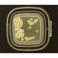 極東製薬工業 DDチェッカー(細菌検出用培地) TGSE寒天培地 黄色ブドウ球菌検出用 1箱(100枚入) 04251 1箱(100枚)（直送品）