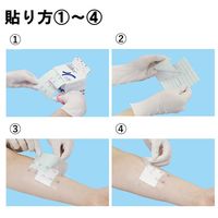 共和　ミリオンエイド　ドレッシングテープ　100mm×10m　MA-E100-A　1巻