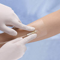 アルケア　マルチフィックス　2号（60×70mm）　16381　1箱（100枚入）