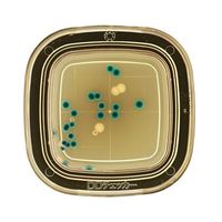 極東製薬工業 細菌検出用培地 DDチェッカー (MAX寒天)1ケース(20枚×2箱入) 04230 1ケース(40枚) 6-8778-38（直送品）