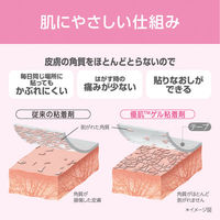 ニトムズ (優肌)パーミロール 14R15 1巻　フィルムドレッシング（防水フィルムロール）（わけあり品）