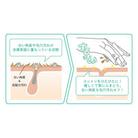 アロインス化粧品 アキュネ　薬用ふきとりローションＵ　２００ｍｌ 4956962111352 1個(200ML)（直送品）