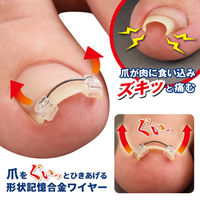 サイプラス 巻き爪ワイヤーガード 004339 1個