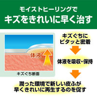 ニチバン 家庭用創傷パッド 救急絆創膏 ケアリーヴ 治す力 ジャンボサイズ 80mm×100mm CN4J 1箱（4枚入）