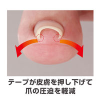 サイプラス 透明巻き爪テープ ミエーヌ10枚入り 005992 1個