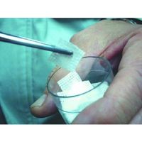 エスコ 2.0x180mm ピンセット(直) EA595GC-7 1セット(15本)（直送品）