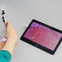 SCOPE JーSCOPE 高速オートフォーカス血流スコープ 血流観察装置 HJーG6 MMS-032-11 1個（直送品）