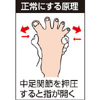 ソルボ　外反母趾サポーター薄型M右　M(23.5～25.0cm)　63079　1個