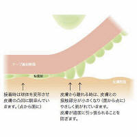 スリーエム ジャパン 3M ベビースキンサージカルテープ（医療用テープ） 50mm×7m 1750-2 1箱（6巻入）