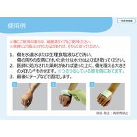 ガーゼ 非固着性 メロリン（未滅菌） 50cm×700cm （ロール） 1巻 66974930 スミス・アンド・ネフュー