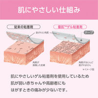 ニトムズ (優肌)パーミロール 14R15 1巻　フィルムドレッシング（防水フィルムロール）（わけあり品）