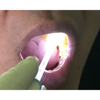 【口腔ケアスポンジ】 スポンジブラシ ピカスポ光るスポンジブラシ X351P00 1個 ベテル