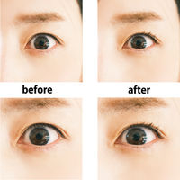 KQ3142 軽い力でカール 5個 貝印