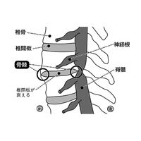 文響社 頚椎症 首のヘルニア 首と脊椎の名医が教える 最高の治し方大全 1327 1冊