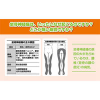 文響社 坐骨神経痛 足腰の名医が教える最高の治し方大全 1373 1冊