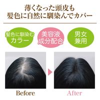 ニーズ 頭皮+髪用ファンデーション ナチュラルブラック 1-00060-002 1個（直送品）