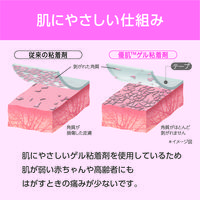 ニトムズ (優肌)パーミロール 14R10 5巻　フィルムドレッシング（防水フィルムロール）