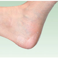 アルケア マルチフィックス・ロール 5号（50mm×10m） 17821 5巻