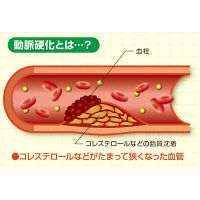 ヘルスオイル 180カプセル ピップ　動脈硬化症の予防 高コレステロール血症の改善【第3類医薬品】