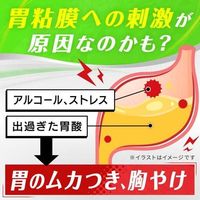 サクロン錠 4錠入×10包 エーザイ 胃薬 ムカムカ 胸焼け 飲み過ぎ【第2類医薬品】
