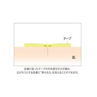 共和 アトレスケア(傷跡ケア専用テープ) 50×50mm 30枚 No.M30 1箱(30枚) 64-6446-21（直送品）