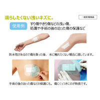 絆創膏 ばんそうこう 防水 通気性 低刺激粘着剤 オプサイト Post-Op2 9.5cm×8.5cm 20枚 66000709 スミス・アンド・ネフュー