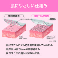 ニトムズ 優肌絆プラスチック 3515 1箱(6巻入)　サージカルテープ（医療用テープ）