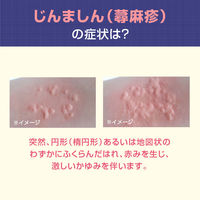 ジンマート錠 14錠 ロート製薬　飲み薬 蕁麻疹  じんましん かゆみ 鼻炎 抗アレルギー薬 メキタジン【第2類医薬品】