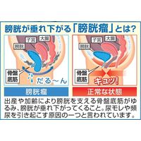イザヴェル 骨盤底筋ベルト モレナレディ 1枚 L a2670503 1個