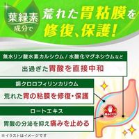サクロン錠 4錠入×10包 エーザイ 胃薬 ムカムカ 胸焼け 飲み過ぎ【第2類医薬品】