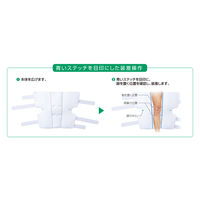 アルケア ニーブレース・FX M 20874 1箱(1個入)