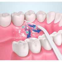 【口腔洗浄器】 充電式口腔洗浄器 ジェットウォッシャー 4種類ノズル付き IPX5防水 3段階水圧調整 1台（直送品）