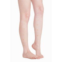 日本薬興 東洋医学療法の鍼治療 皮内針「ひ鍼」 30針 Q00510 1セット(30針入)（直送品）