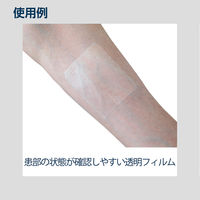 アズワン ナビス フィルムドレッシング SD0607 8-598-01 1箱(1枚×20袋入)