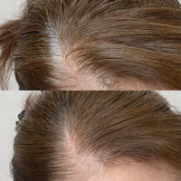 アウラ ルミナ ヘアカラー リタッチ 20g 462 1本（直送品）